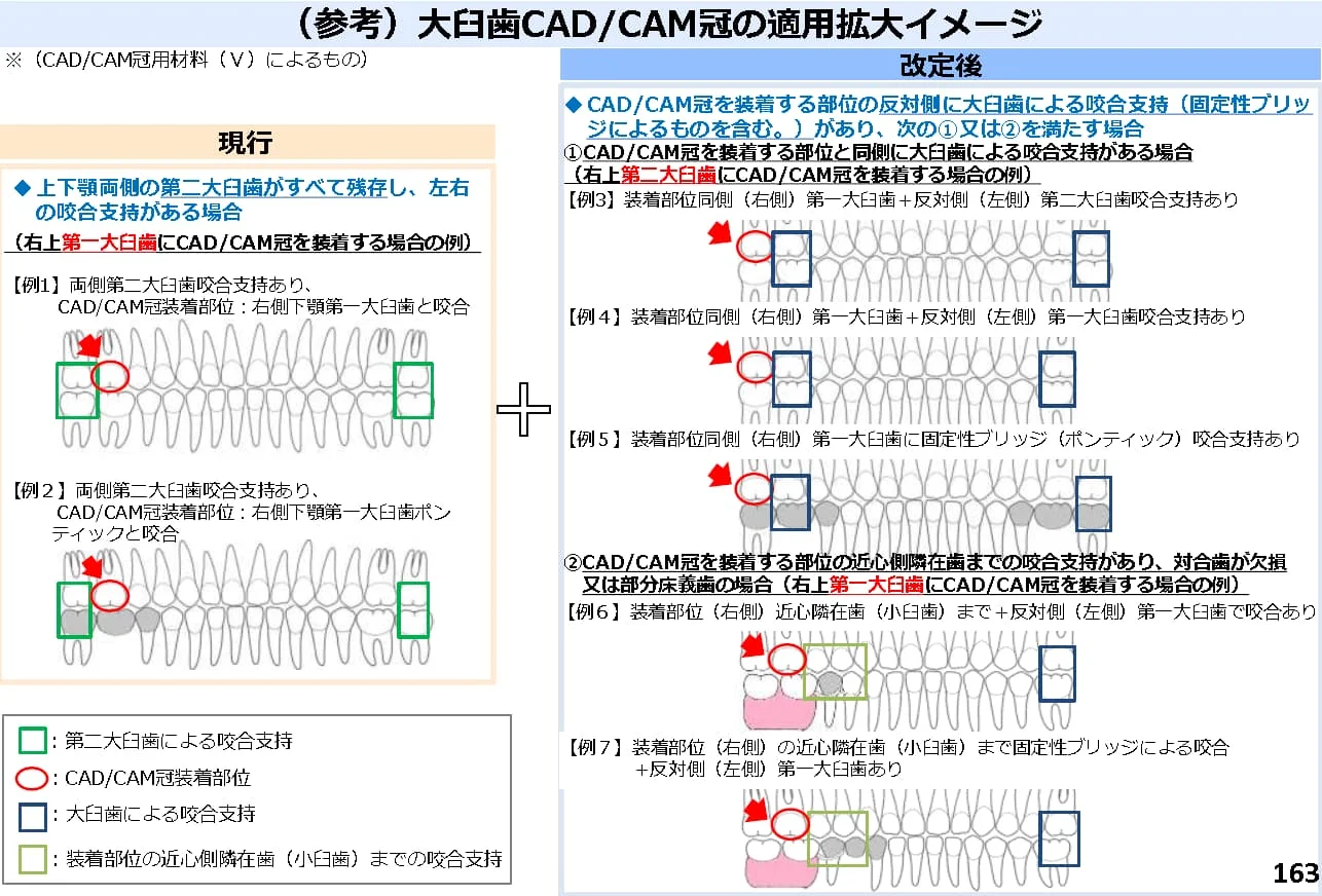 大臼歯CAD/CAM冠の適用拡大イメージ